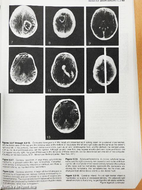 Synopsis of Psychiatry