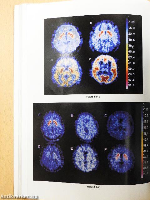 Synopsis of Psychiatry