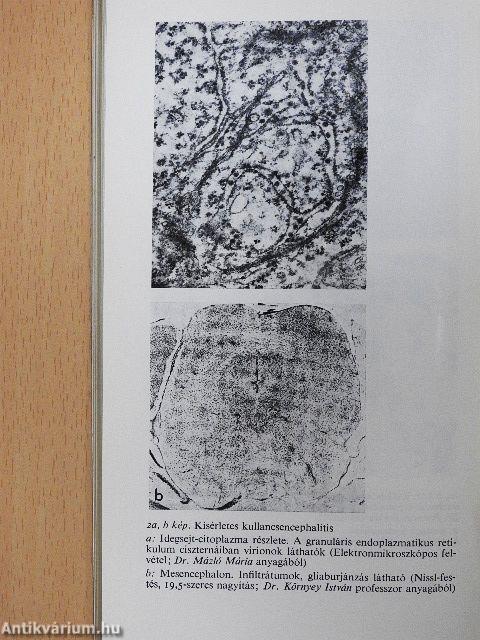 A kullancsencephalitis