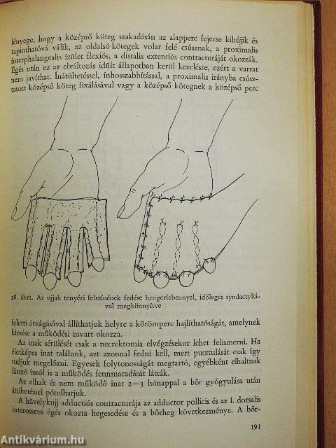 Égési sérülések