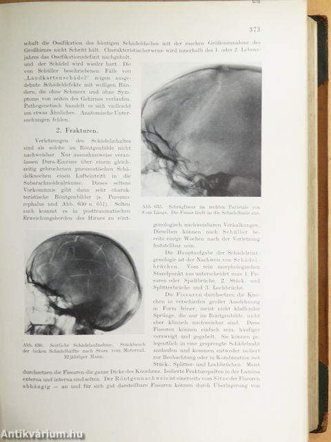 Lehrbuch der Röntgendiagnostik