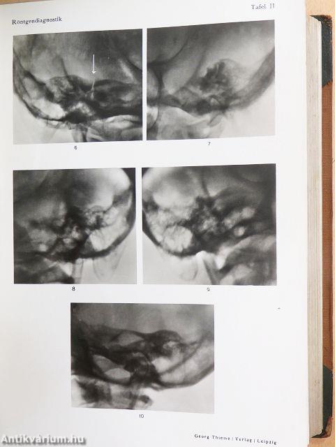 Lehrbuch der Röntgendiagnostik