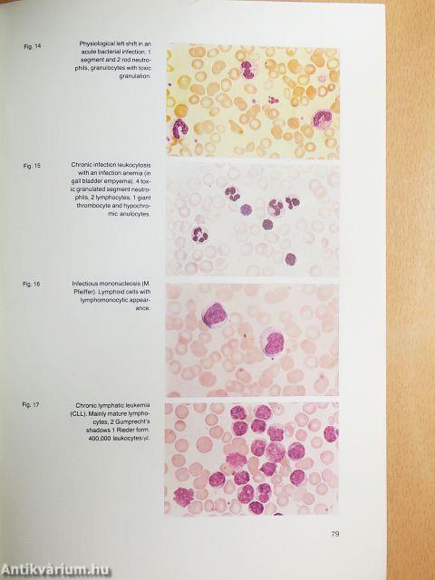 Hematological Laboratory Methods