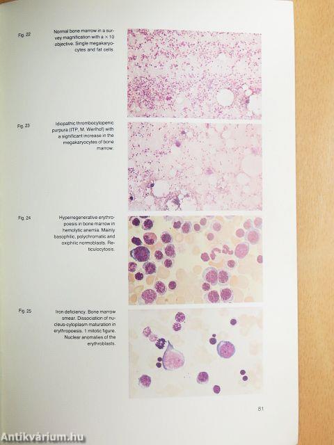 Hematological Laboratory Methods