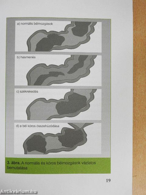 Hasfájás, puffadás - irritábilis bél szindróma?