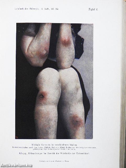 Lehrbuch der Chirurgie III.
