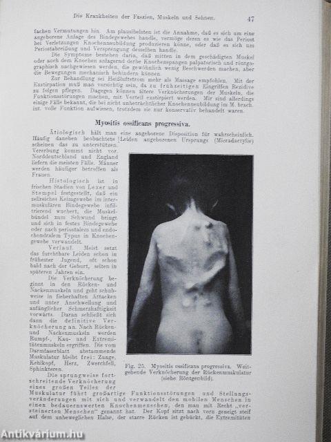 Lehrbuch der Chirurgie III.