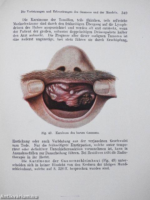 Lehrbuch der Chirurgie I.