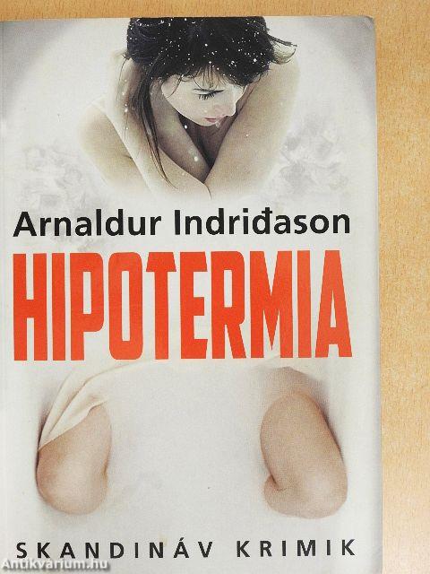 Hipotermia