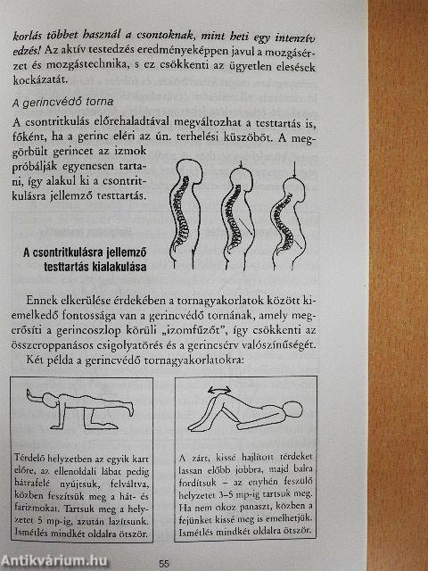 A néma járvány: csontritkulás