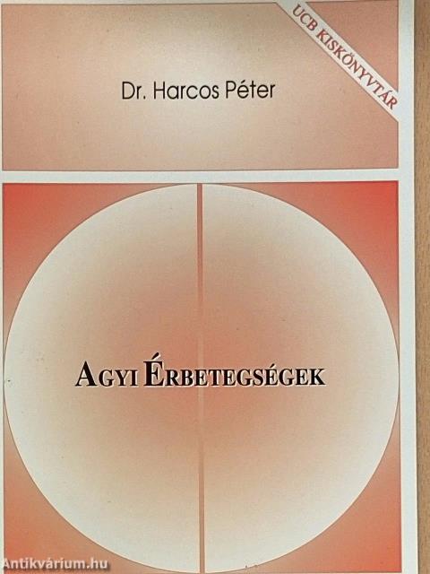Agyi érbetegségek