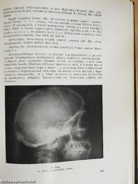 A Heves Megyei Kórház évkönyve 1975.