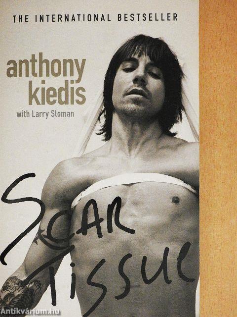 Scar Tissue