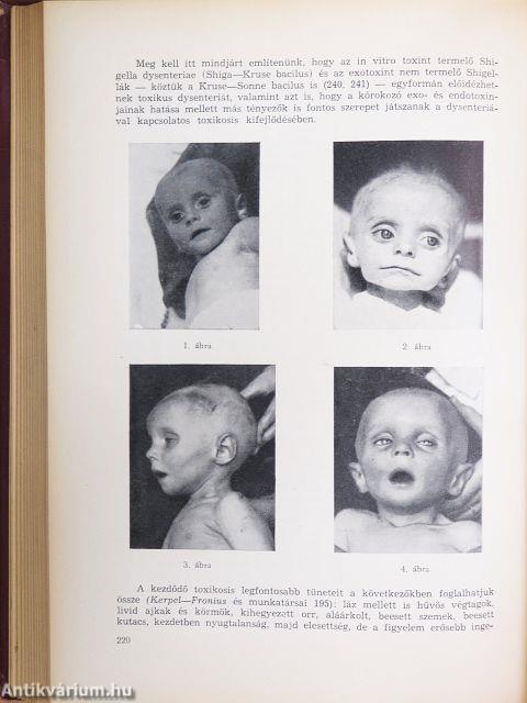Dysenteria