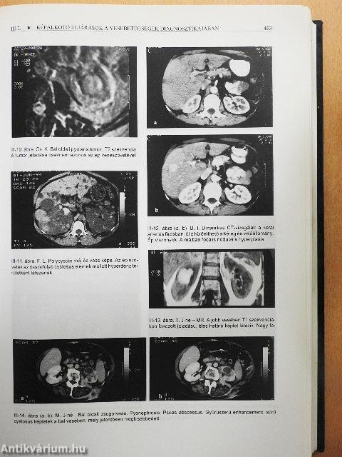 Nephrologia