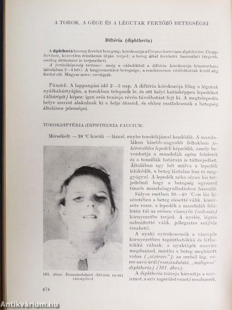 A beteg gyermek 1-2.