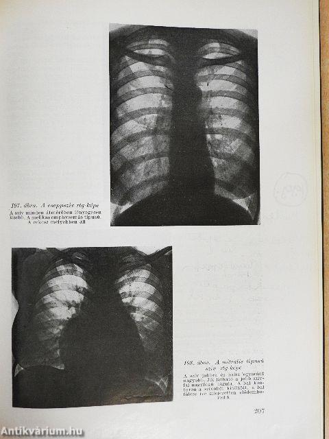 A radiologia alapvonalai