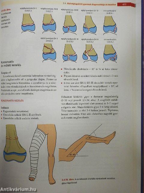 Gyermektraumatológia