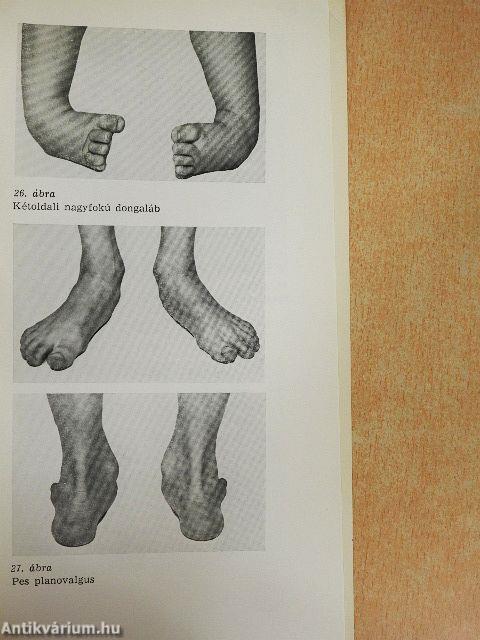 Gyermek-orthopaedia