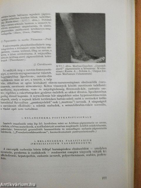 Határterületi differenciál-diagnosztika