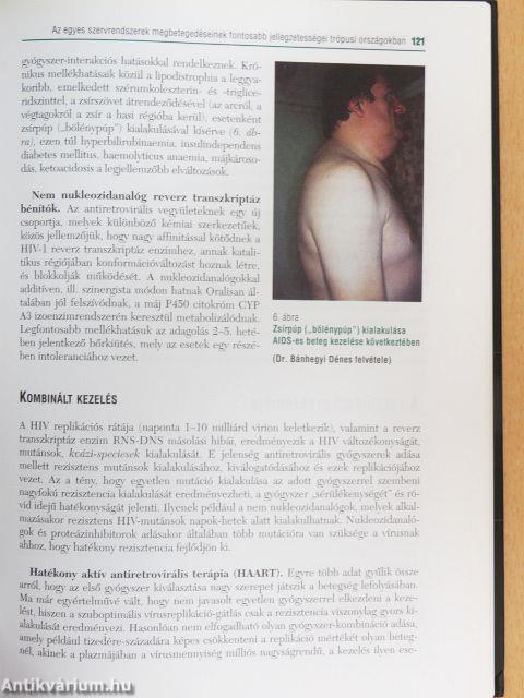 Trópusi medicina