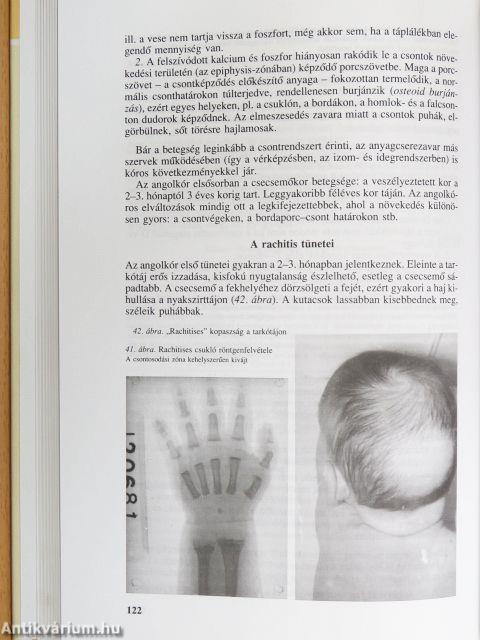 Gyermekápolástan 1-2.