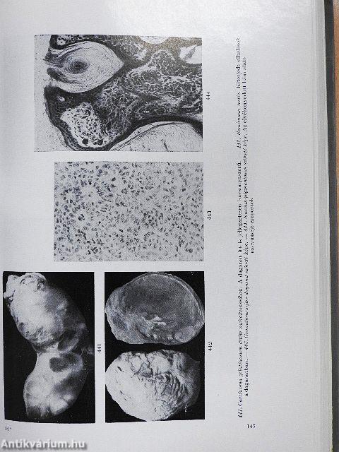 A kórbonctan elemei 1-3.