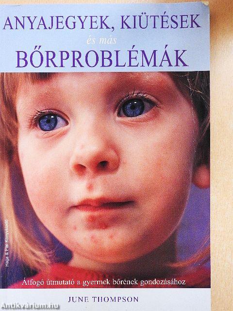 Anyajegyek, kiütések és más bőrproblémák