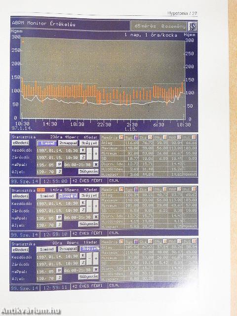 ABPM atlasz