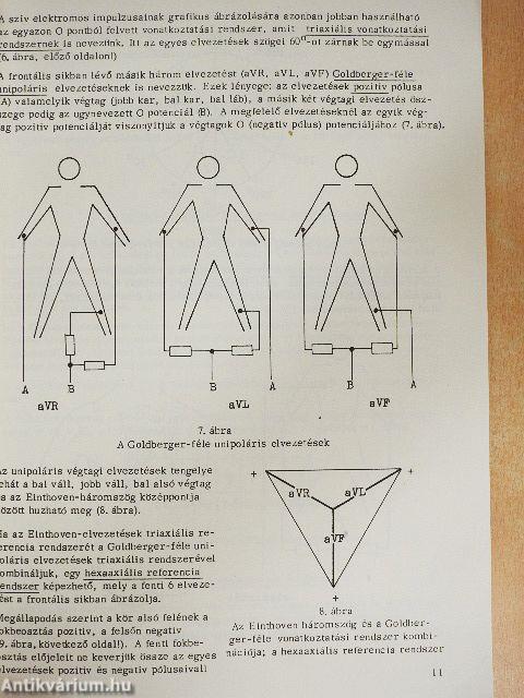 EKG-alapismeretek