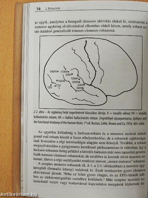 Epilepszia