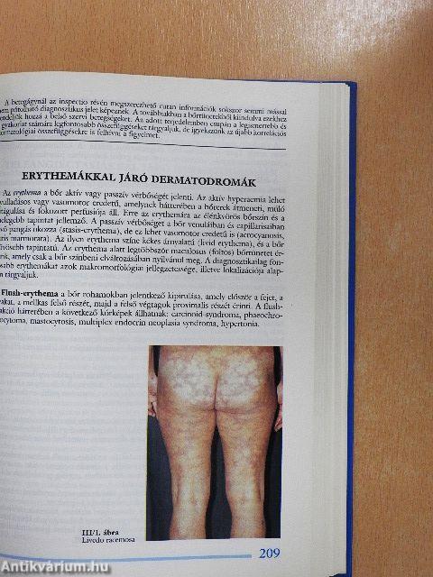 Differenciáldiagnosztikai kalauz