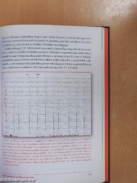 EKG