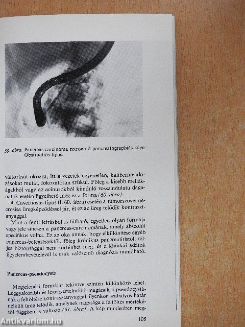 Gastrointestinalis endoscopia