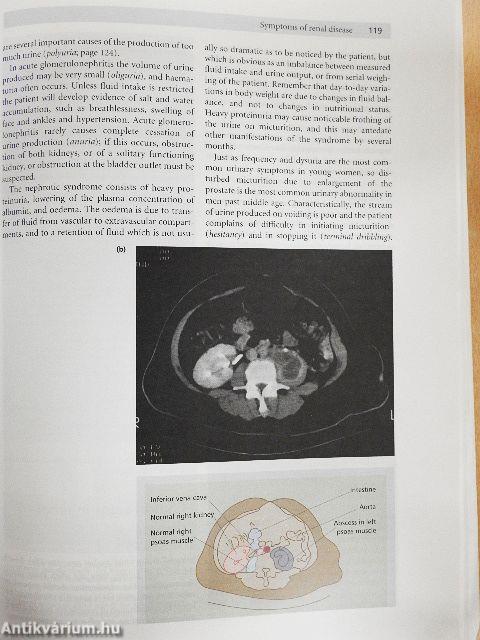 Hutchison's Clinical Methods