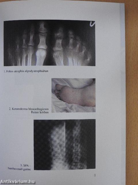 Gyakorlati reumatológia