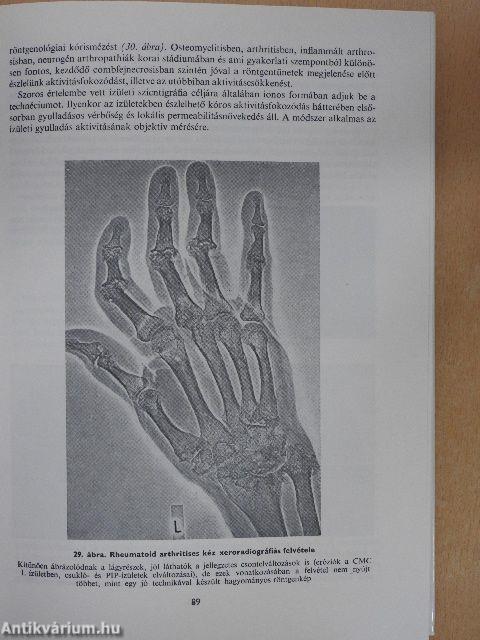 Reumatológia