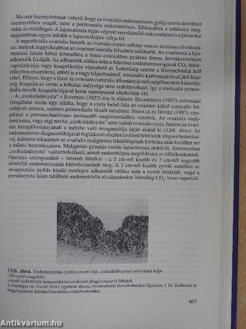 Nőgyógyászati endokrinológia