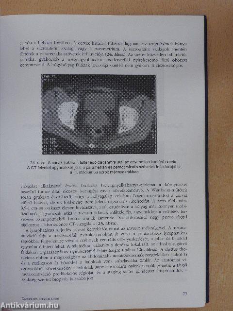 Nőgyógyászati onkológia