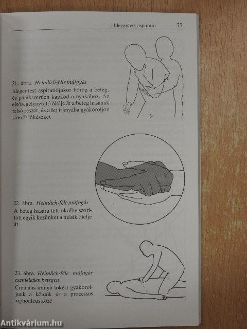 Újraélesztés