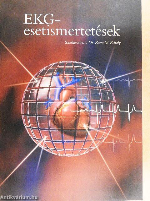 EKG esetismertetések