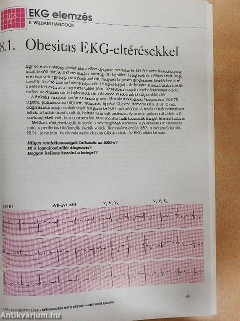 EKG esetismertetések