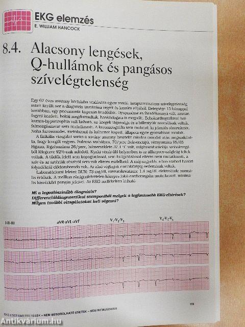 EKG esetismertetések