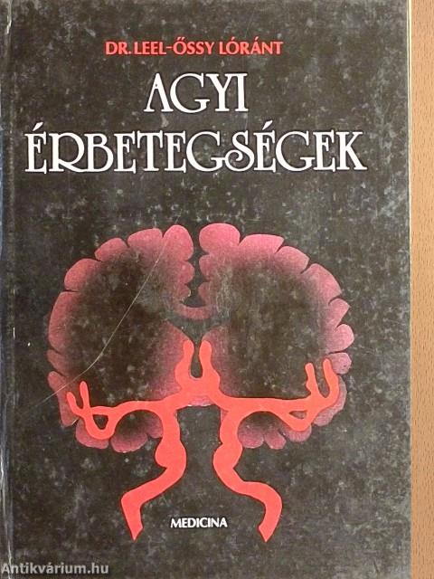 Agyi érbetegségek