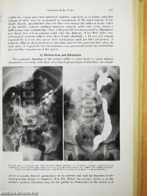 Malformations