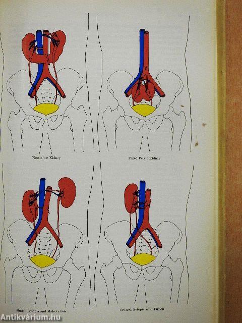 Malformations