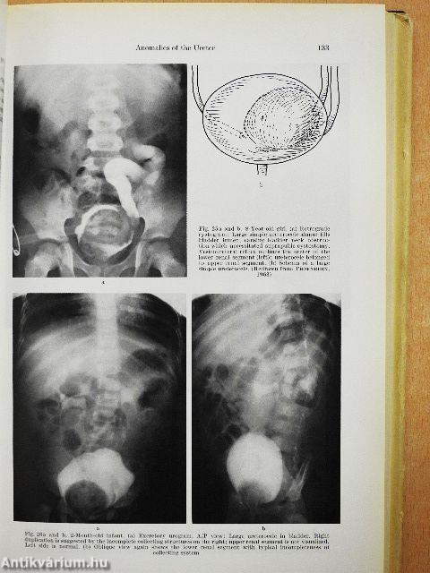 Malformations