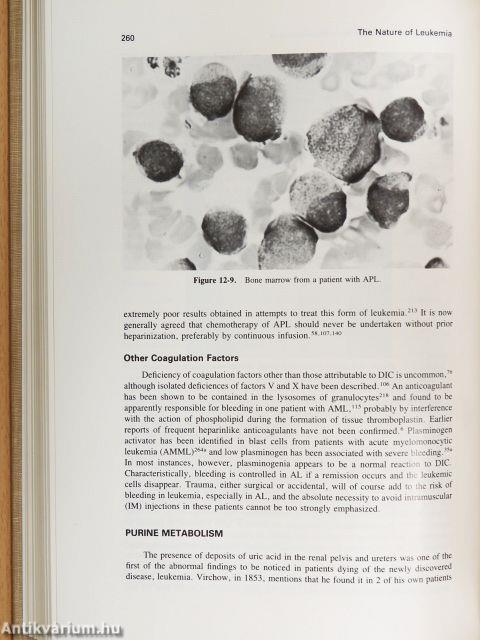 Leukemia