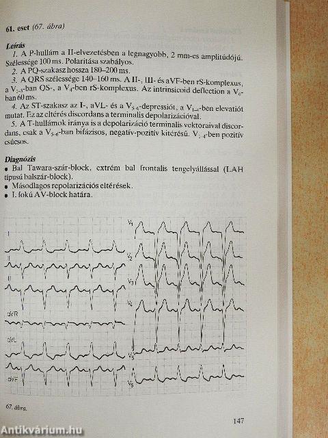 EKG atlasz