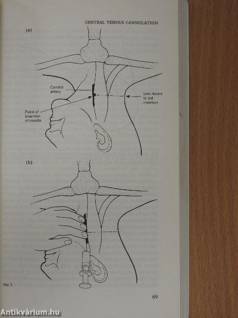 Procedures in Practice